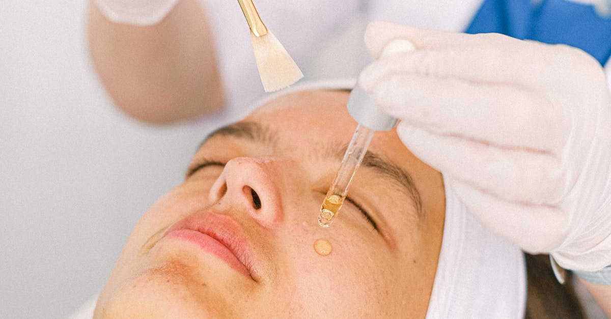How to Choose the Right Laser Treatment for Hyperpigmentation