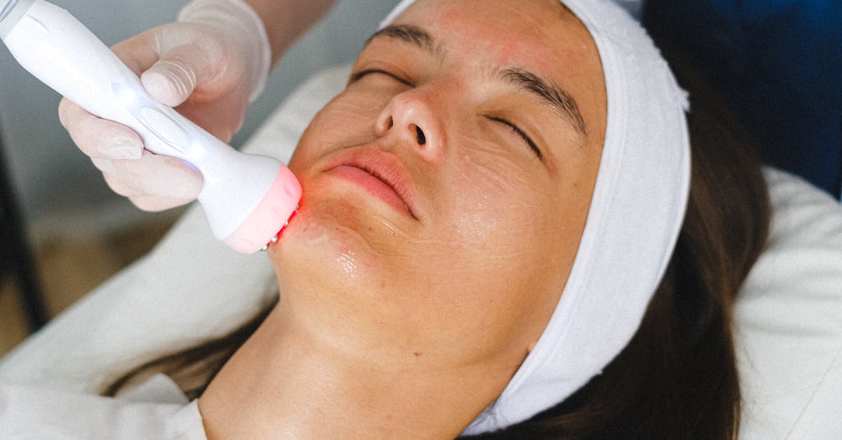 Laser Treatments for Uneven Pigmentation: What You Need to Know