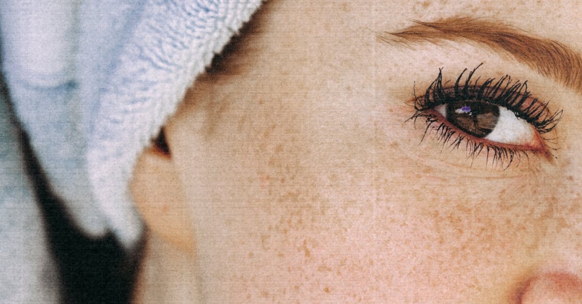 Top Tips for Post-Laser Treatment Skin Recovery